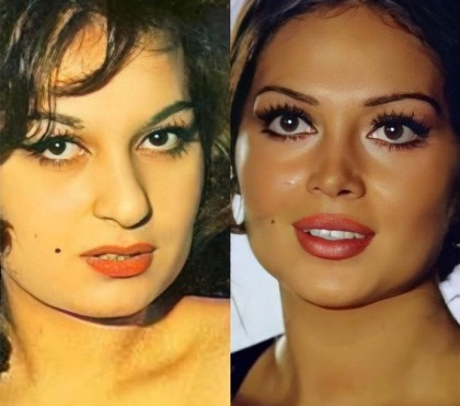 kullanıcı tarafından yüklenmiş görsel