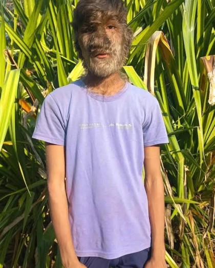 kullanıcı tarafından yüklenmiş görsel