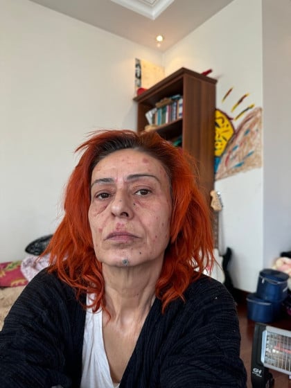 kullanıcı tarafından yüklenmiş görsel