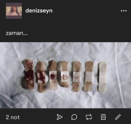 kullanıcı tarafından yüklenmiş görsel