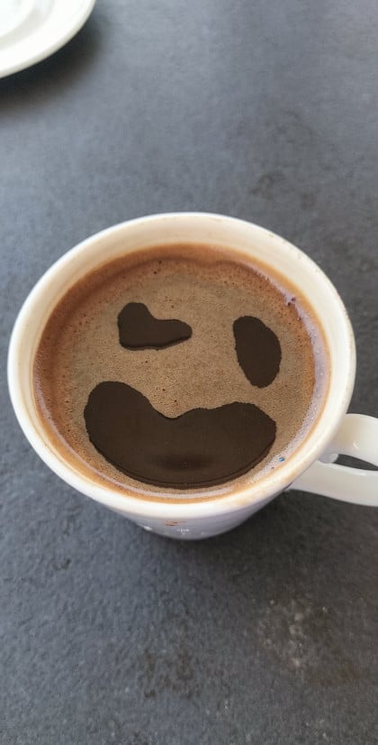 kullanıcı tarafından yüklenmiş görsel