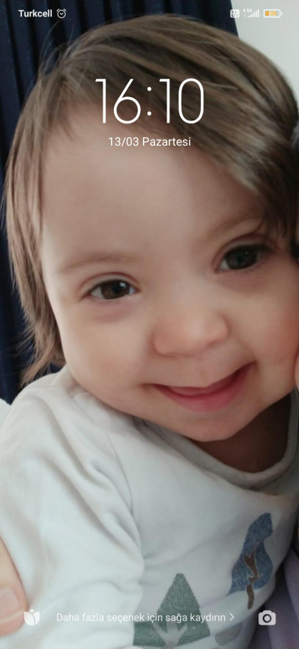 kullanıcı tarafından yüklenmiş görsel