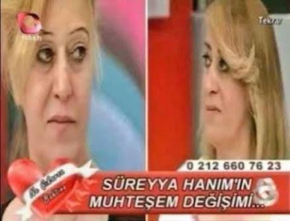 kullanıcı tarafından yüklenmiş görsel