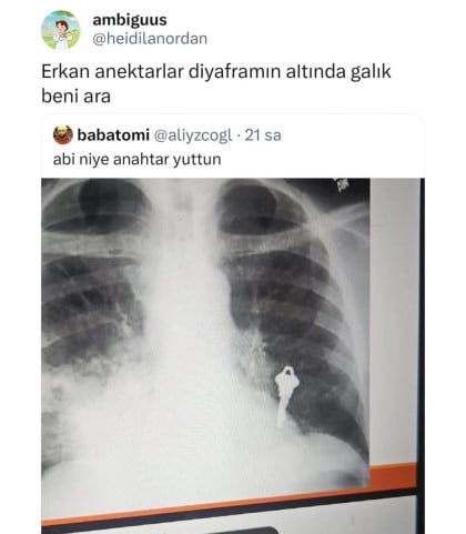 kullanıcı tarafından yüklenmiş görsel