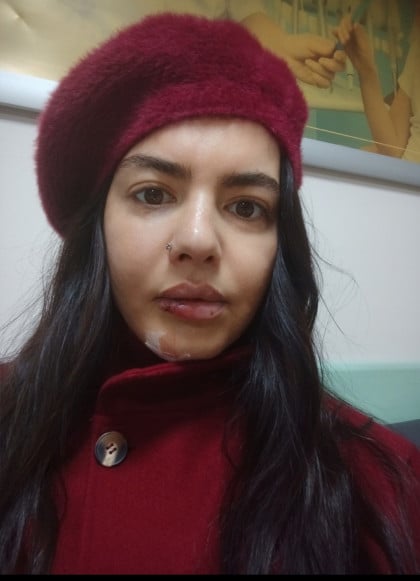 kullanıcı tarafından yüklenmiş görsel