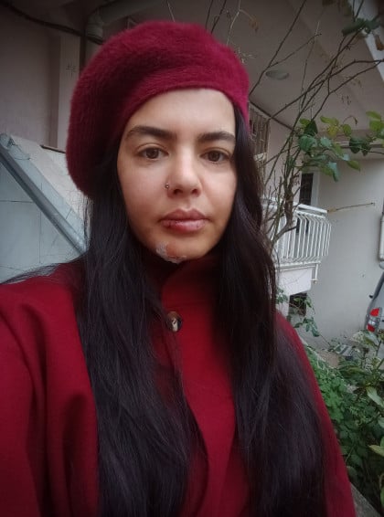 kullanıcı tarafından yüklenmiş görsel