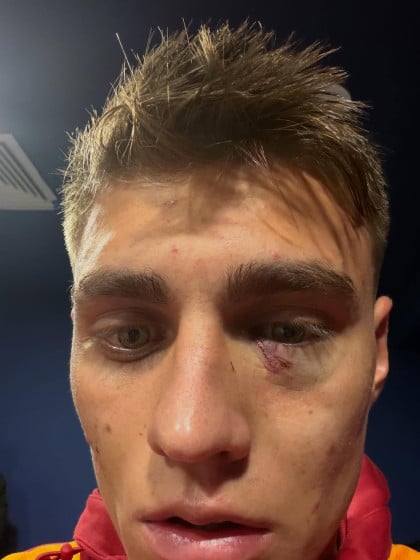 kullanıcı tarafından yüklenmiş görsel