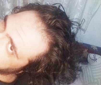 kullanıcı tarafından yüklenmiş görsel