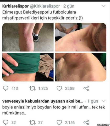 kullanıcı tarafından yüklenmiş görsel