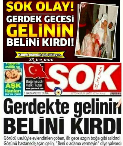 kullanıcı tarafından yüklenmiş görsel