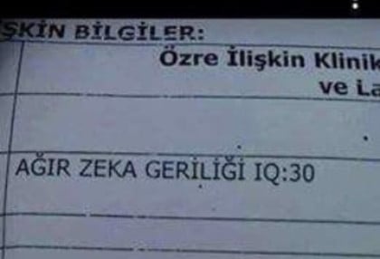 kullanıcı tarafından yüklenmiş görsel