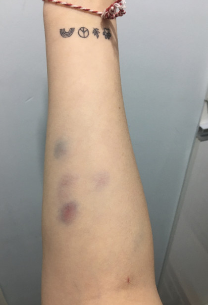 kullanıcı tarafından yüklenmiş görsel