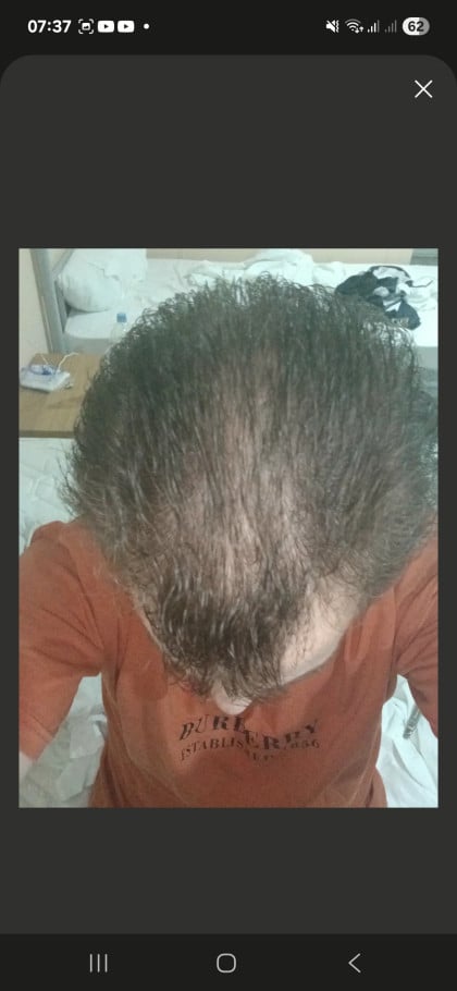 kullanıcı tarafından yüklenmiş görsel