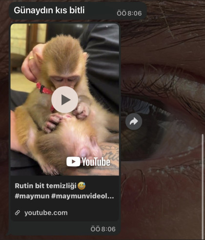 kullanıcı tarafından yüklenmiş görsel