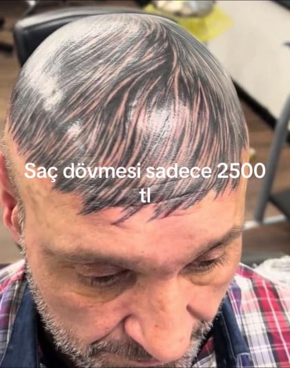 kullanıcı tarafından yüklenmiş görsel