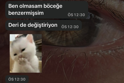 kullanıcı tarafından yüklenmiş görsel