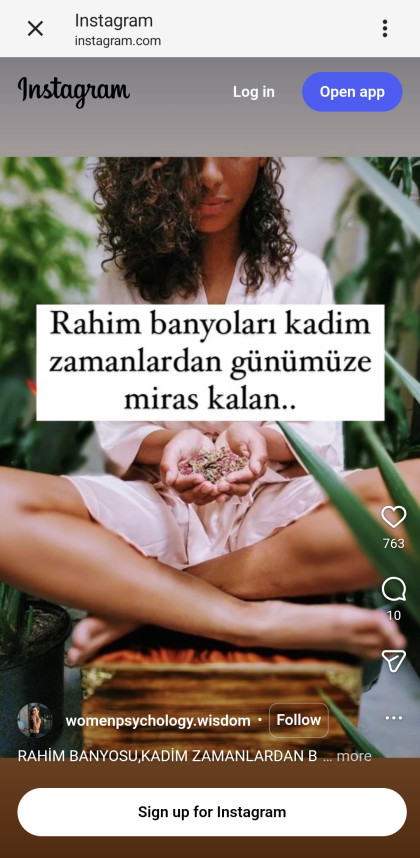 kullanıcı tarafından yüklenmiş görsel