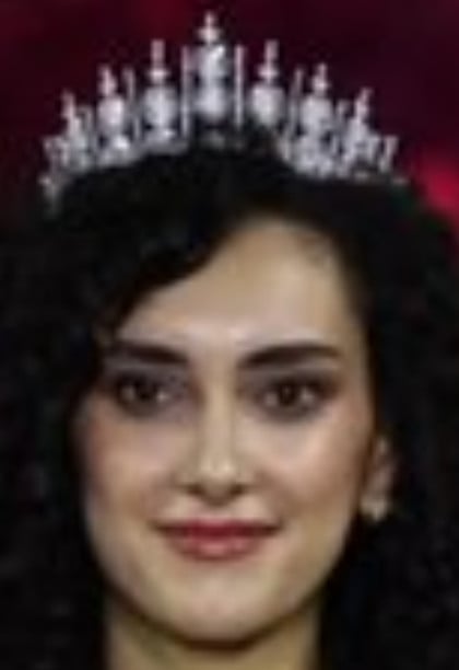 kullanıcı tarafından yüklenmiş görsel