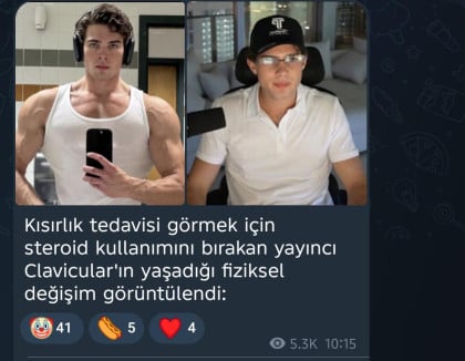 kullanıcı tarafından yüklenmiş görsel
