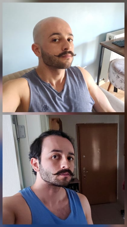 kullanıcı tarafından yüklenmiş görsel