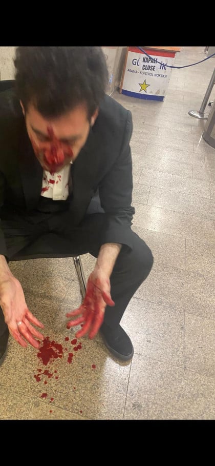 kullanıcı tarafından yüklenmiş görsel