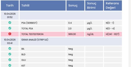 kullanıcı tarafından yüklenmiş görsel