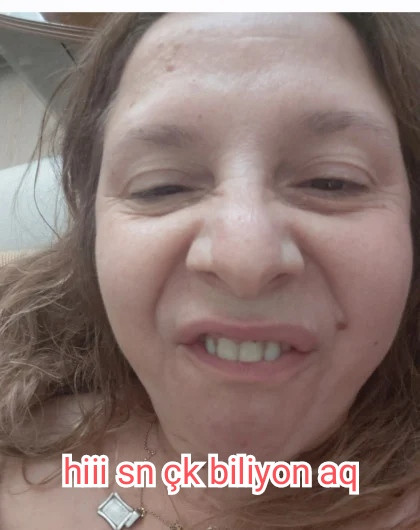kullanıcı tarafından yüklenmiş görsel