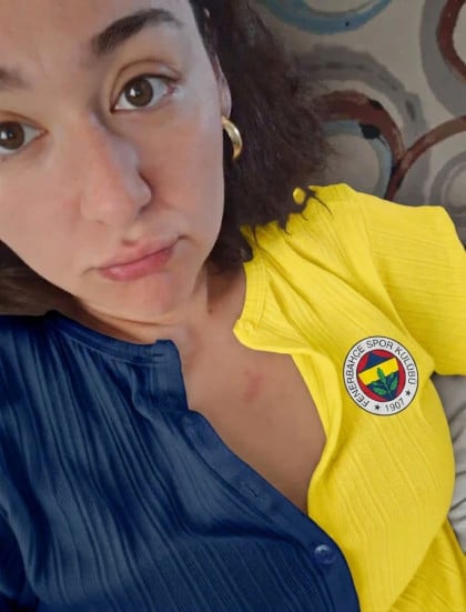kullanıcı tarafından yüklenmiş görsel