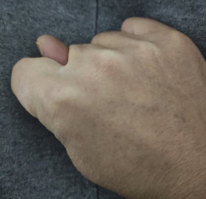 kullanıcı tarafından yüklenmiş görsel