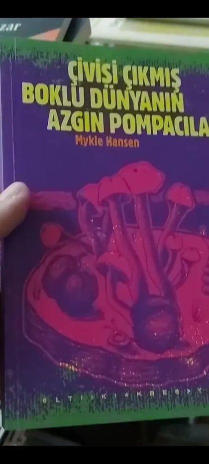 kullanıcı tarafından yüklenmiş görsel